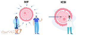 روش میکرواینجکشن (ICSI) چیست و چه تفاوتی با IVF دارد؟