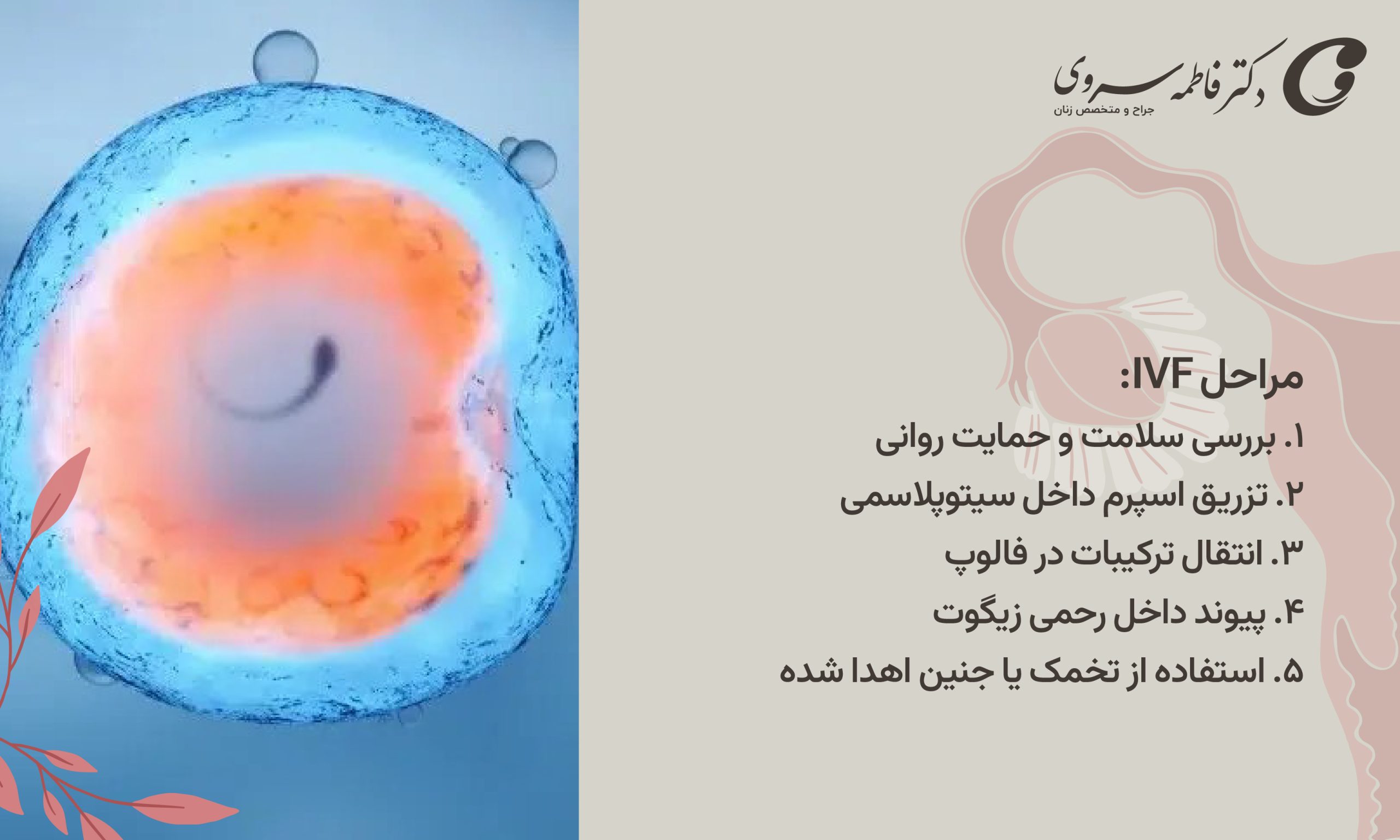 مراحل IVF