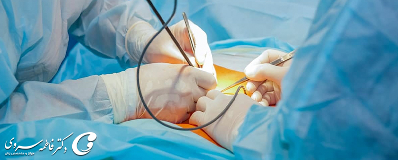 عوارض احتمالي لاپاروسكوپي و راه هاي درمان آن