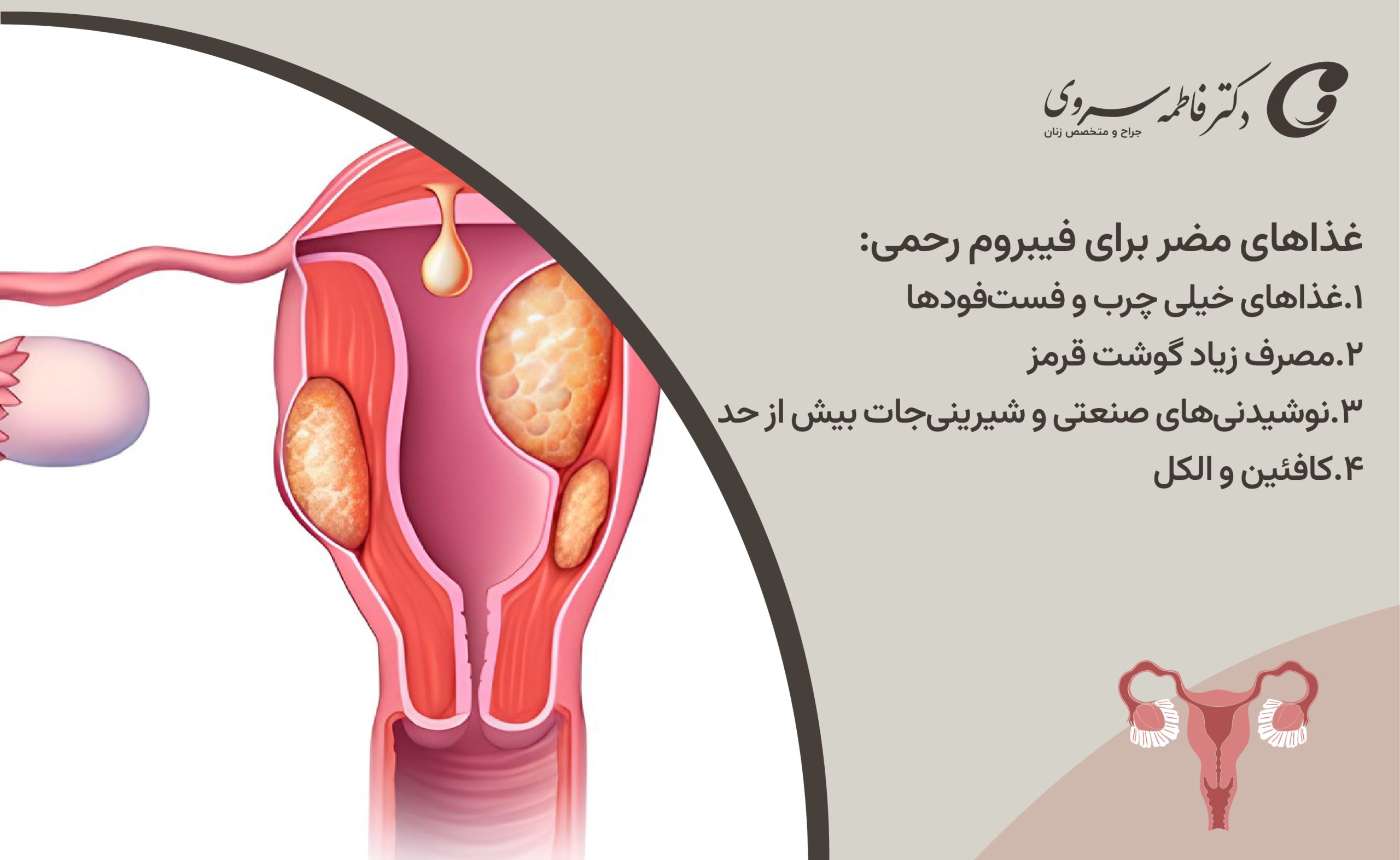 غذاهای مضر برای فیبروم رحمی