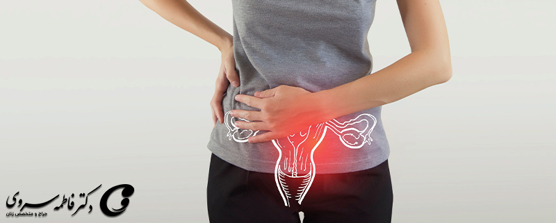 کیست تخمدان (بررسی انواع کیست تخمدان و روش های درمان)