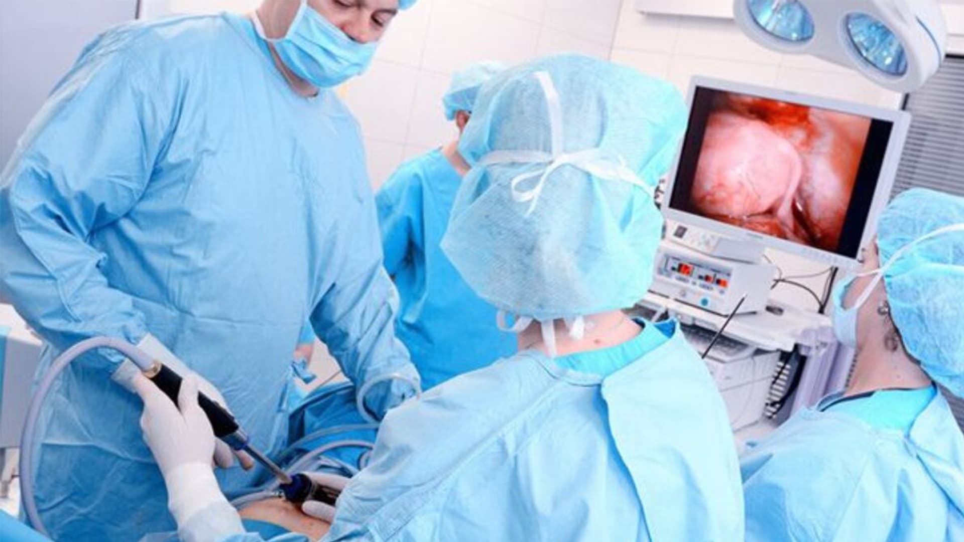 تفاوت جراحی باز با لاپاراسکوپی