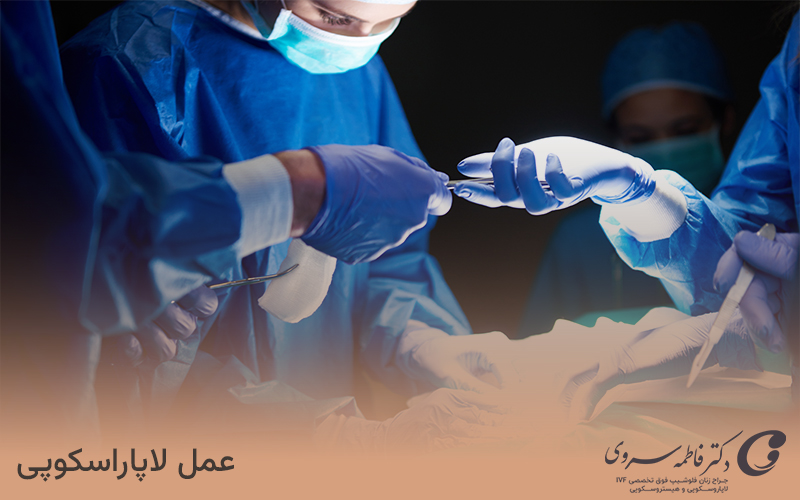 عمل لاپاراسکوپی