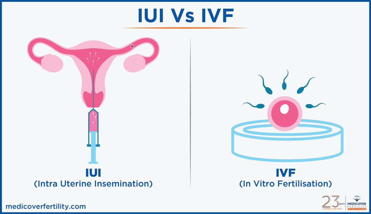 In vitro fertilization это. IUI. What is IUI. IVF порноактриса.