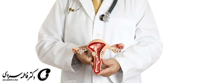 میوم های رحمی و ارتباطش با ناباروری