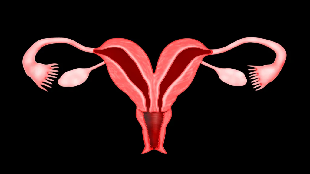 چه چیزی باعث سپتوم رحم می‌شود؟