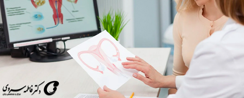 فیبروم رحم و نکات تغذیه مناسب آن