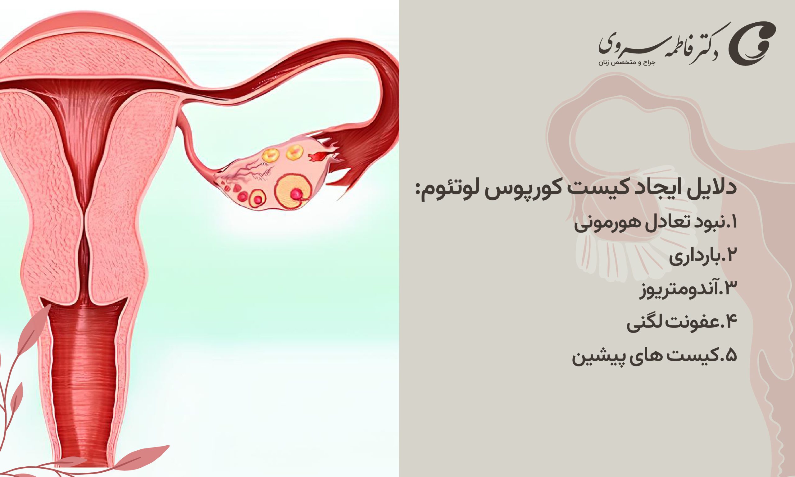 دلایل ایجاد کیست کورپوس لوتئوم