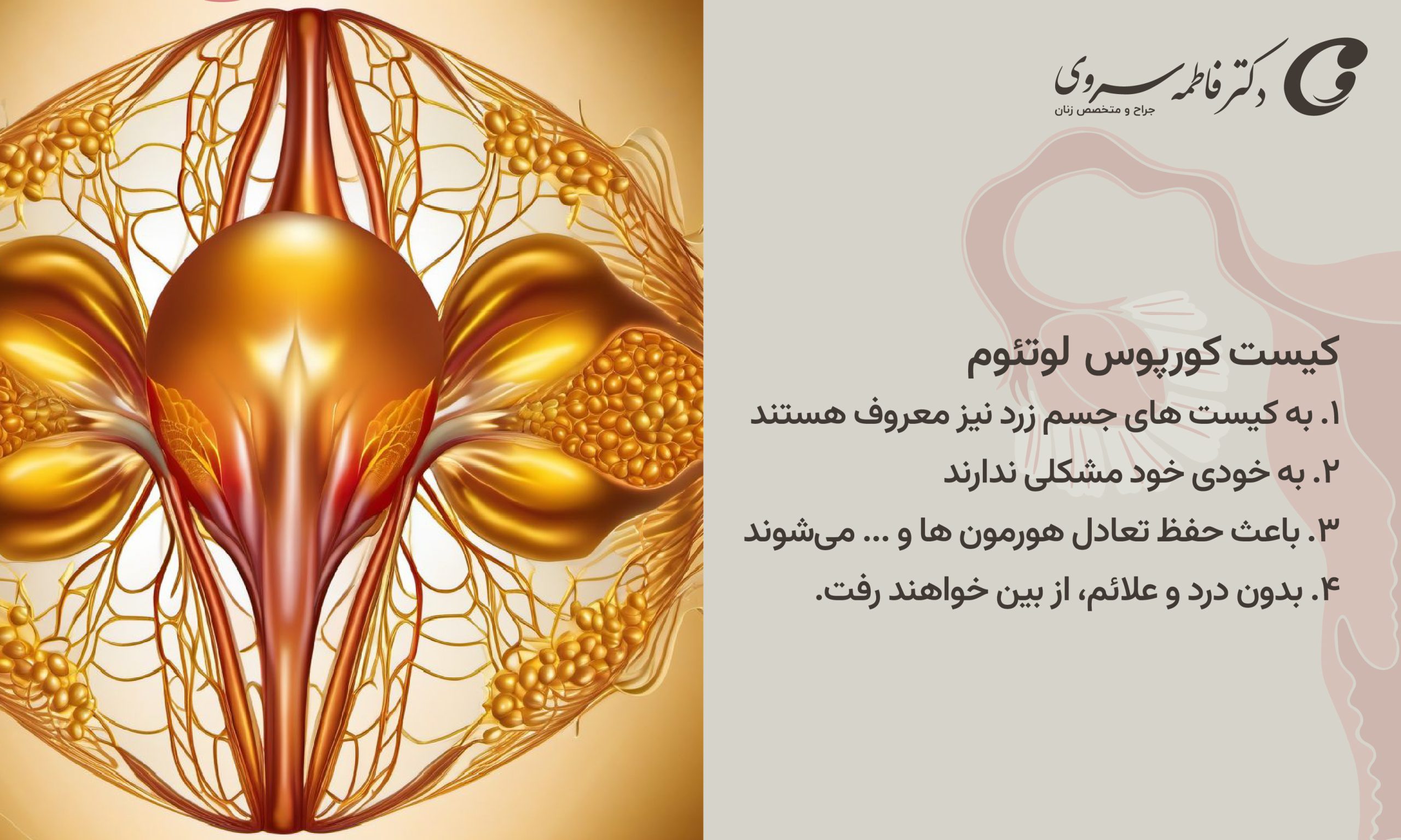 کیست کورپوس لوتئوم