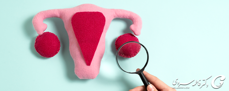 کیست کورپوس لوتئوم را بشناسید