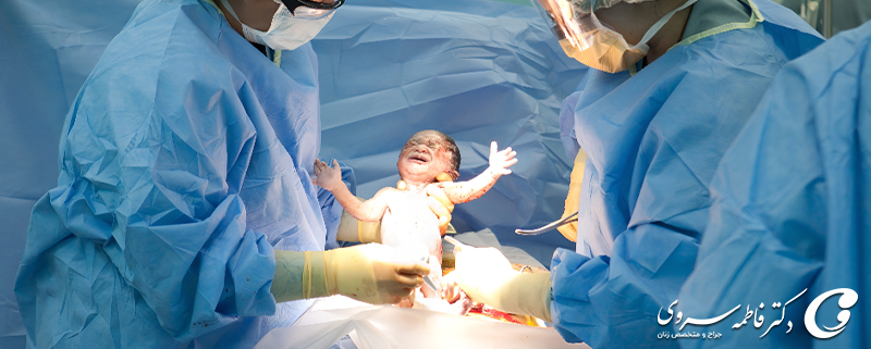 مهارت پزشک سزارین
