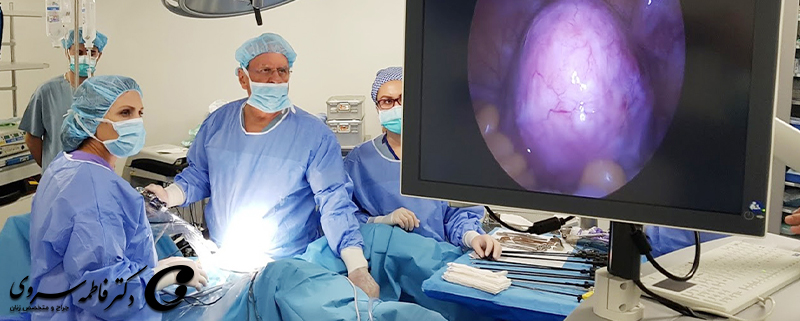 میومکتومی چیست؟