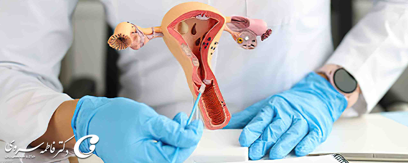 عمل هیسترکتومی چیست و چگونه انجام می شود؟